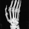 X-ray scan of the museum's mummy hand